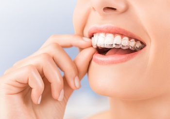 ฟันสวยแบบรวดเร็วด้วยการจัดฟันแบบใส (Invisalign) กับ Plus Dental