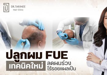ปลูกผม FUE ไร้แผลผ่าตัด คืนความมั่นใจแบบไม่ต้องพักฟื้น