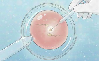 ICSI: พลิกโอกาส “มีลูกยาก” ลดความเสี่ยงมดลูกแตกซ้ำ เทคโนโลยีที่แม่ท้องต้องรู้!