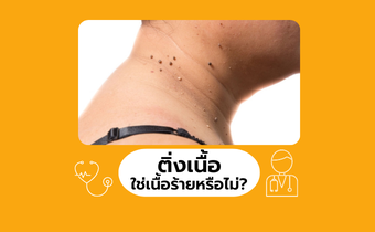 ไขข้อสงสัย? ติ่งเนื้อ ใช่เนื้อร้ายหรือไม่ จะเปลี่ยนเป็นมะเร็งหรือเปล่า