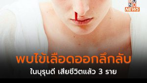 พบโรคอุบัติใหม่ลึกลับใน “สาธารณรัฐบุรุนดี” ผู้เสียชีวิต เลือดกำเดาไหล 3 คน ยังไม่แน่ใจสาเหตุ