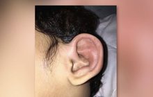 เตือนภัยนอนใกล้ห้องน้ำตะขาบเข้าหู