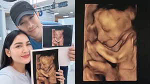 “เจมส์ เรืองศักดิ์” อวดภาพอัลตราซาวด์ลูกสาวคนที่ 2 “น้องมีเมตตา” อายุครรภ์ 6 เดือน ฉายแววน่ารัก ยิ้มหวาน จมูกโด่งตั้งแต่อยู่ในท้อง