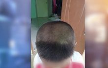 เด็ก ป.1 ร้องไห้โฮ ถูกตัดผมจนเสียทรง