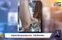 หญิงสาวร้องถูกชายอนาจาร  หวั่นเรื่องเงียบ