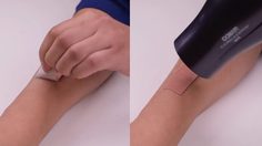 ไม่ต้องร้องซี๊ดอีกต่อไป!! ตามมาดู แกะพลาสเตอร์อย่างไรไม่ให้เจ็บตัว