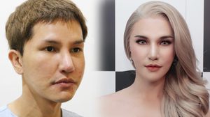 คุณช่า บันทึกของตุ๊ด เล่าประสบการณ์ศัลยกรรมยกเครื่องทั้งหน้า พร้อมวิธีดูแลก่อนและหลังศัลยกรรม