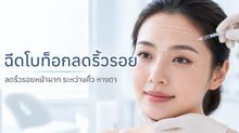 รู้จักฉีดโบลดริ้วรอย ผลลัพธ์ ข้อดี ข้อจำกัด และราคาแต่ละตำแหน่ง