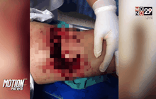 หมีทำร้ายชาวบ้าน จ.บุรีรัมย์