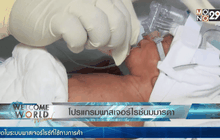 โปรแกรมพาสเจอร์ไรซ์นมมารดา