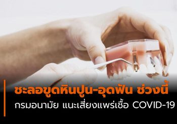 กรมอนามัย แนะชะลอขูดหินปูน-อุดฟัน ช่วงนี้ เสี่ยงแพร่เชื้อ COVID-19