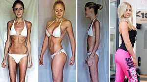 สตรองไม่แพ้กัน! 15 สาว เอาชนะ โรคคลั่งผอม จนกลับมาสวยสุขภาพดี