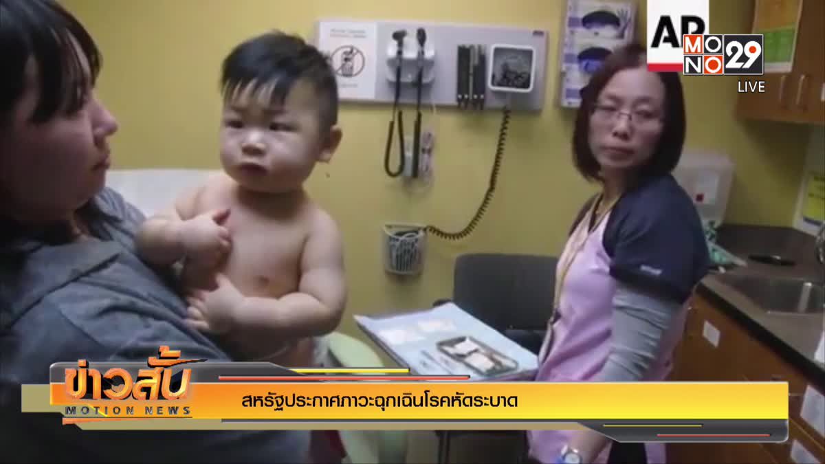 สหรัฐประกาศภาวะฉุกเฉินโรคหัดระบาด