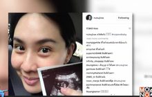 “นุ้ย สุจิรา” ประกาศข่าวดี ตั้งท้องลูกคนที่ 2