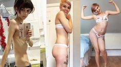 สตรองไม่แพ้ใคร! สาวเปิดประสบการณ์เอาชนะ โรคคลั่งผอม สร้างแรงบันดาลใจให้มั่นใจในตัวเอง