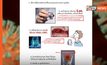 หมอธีระวัฒน์ เผยนวัตกรรมใหม่ ชุดตรวจแบบ “น้ำกลั้วคอ” วัดระดับความเสี่ยงการติดเชื้อโควิด-19 ในระดับต่างๆ