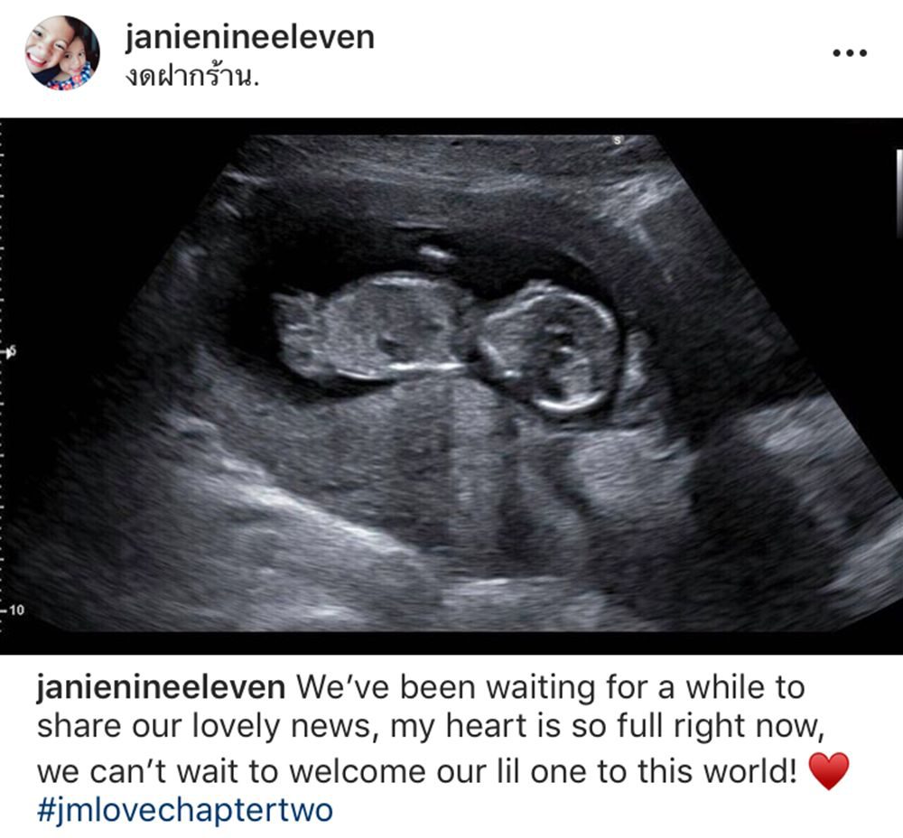 ข่าวดี เจนี่ ตั้งท้องลูกคนแรกแล้ว