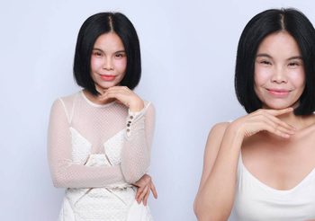 รุ้งลาวัลย์ เปิดใจได้เวลาศัลยกรรม!! ย้อนอายุใบหน้าด้วย Face Lock และ Facial Contour หวังสตาฟหน้าหนูหิ่น