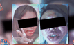 รพ.รามาฯ เร่งตรวจสาเหตุสาวทานอาหารเสริมดับ