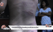 ช่วยเหลือเด็กถูกทำร้ายหลังถูกแชร์ในโลกออนไลน์
