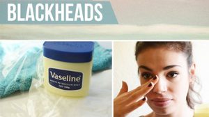 How to วิธีกำจัดสิวหัวดำ ทำง่ายๆ แค่ใช้ วาสลีน!