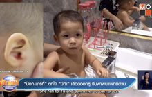 “ป๊อก-มาร์กี้” ตกใจ “มีก้า” เลือดออกหู รีบพาพบแพทย์ด่วน