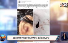ร้องแมลงเข้าหูเลือดไหลไป ร.พ. ถูกไล่กลับบ้าน