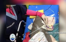 สุดยื้อ”ยามีล” หลังผ่าตัดร่างกายบอบช้ำ