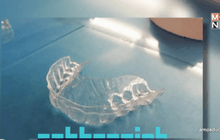 ครอบฟันราคาประหยัดจากเครื่องพิมพ์ 3 มิติ