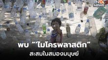 นักวิทย์พบ ‘ไมโครพลาสติก’ สะสมลึกในสมองมนุษย์