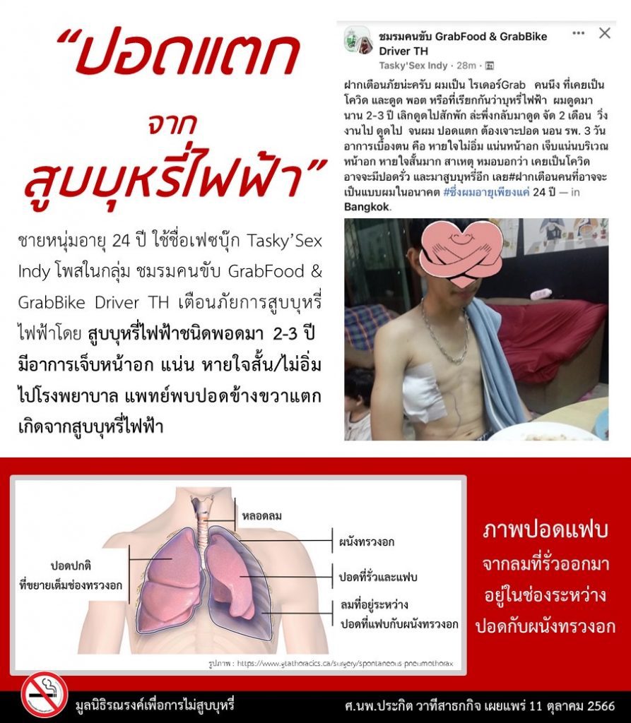 สูบบุหรี่ไฟฟ้า