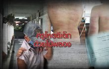 ครูโหดตีเด็กด้วยไม้พลอง