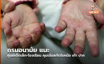 กรมอนามัย แนะ ศูนย์เด็กเล็ก-โรงเรียน คุมเข้มสกัดโรคมือ เท้า ปาก