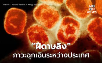 WHO ประกาศให้ “ฝีดาษลิง” เป็นภาวะฉุกเฉินระหว่างประเทศ