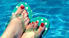 10 แฟชั่นวายร้าย ที่ทำร้ายสุขภาพ แบบเงียบๆ โดยที่คุณไม่เคยรู้ตัว!!