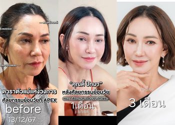 ปังมากแม่ “ดี้ ปัทมา” อัพเดทดึงหน้า ครบ 3 เดือน สวยจนคนทัก!