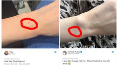 มีคนบอกว่า ผู้หญิงทุกคนมีขี้แมลงวันที่ข้อมือ เช็คซิ๊แขนเธอล่ะ..มีมั้ย?