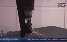 ออสเตรียสร้างขาเทียมที่รับรู้ความรู้สึกได้