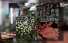 โรคมือ เท้า ปาก 3 วันตาย ?