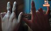 เพจดังโพสต์ภาพ มือพิการระดับไหน จึงได้สิทธิ?