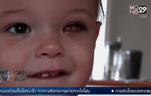 พบว่าลูกชายเป็นมะเร็งจากไอโฟน