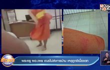 พระอาจารย์เฆี่ยนพระลูกศิษย์เนื้อแตก-ไม้หัก