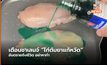อย. สหรัฐฯ เตือนวัยรุ่นทำชาเลนจ์ “ไก่ต้มยาแก้หวัด”เสี่ยงอันตรายถึงชีวิต