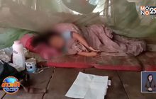 หมอแจงปมไม่รักษาเด็ก  4 ขวบ ป่วยตาบวมอักเสบ