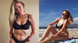 สาวแขนด้วนใจสู้ พลิกคำดูถูกเป็นพลัง จากคิดฆ่าตัวตาย กลับมายิ้มให้ชีวิตได้อีกครั้ง