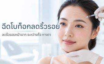 รู้จักฉีดโบลดริ้วรอย ผลลัพธ์ ข้อดี ข้อจำกัด และราคาแต่ละตำแหน่ง