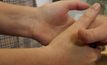 กิจกรรมสร้างรอยประทับการจับมือในเยอรมนี