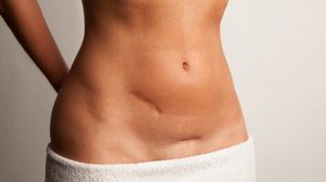 ผู้หญิงอายุ 25ขึ้นไป โดยเฉพาะมีเพศสัมพันธ์แล้ว ควรตรวจคัดกรอง มะเร็งปากมดลูก ด้วยวิธีเซลล์วิทยา (HPV DNA)