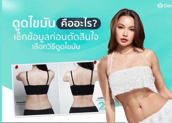 ดูดไขมัน (Liposuction) คืออะไร? ออกแบบหุ่นให้สวยได้จริงไหม