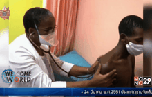 24 มี.ค. วันวัณโรคโลก